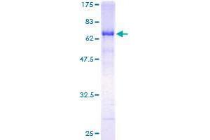Radil Protein (AA 1-371) (GST tag)