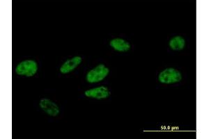 Immunofluorescence of purified MaxPab antibody to FBXO34 on HeLa cell. (FBXO34 anticorps  (AA 1-711))