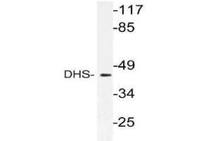 Western blot (WB) analysis of DHS antibody in extracts from 3T3 cells.