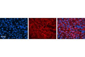 DHODH antibody - C-terminal region          Formalin Fixed Paraffin Embedded Tissue:  Human Liver Tissue    Observed Staining:  Cytoplasm in hepatocytes   Primary Antibody Concentration:  1:100    Secondary Antibody:  Donkey anti-Rabbit-Cy3    Secondary Antibody Concentration:  1:200    Magnification:  20X    Exposure Time:  0. (DHODH anticorps  (C-Term))