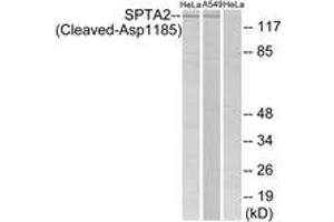 Western blot analysis of extracts from HeLa/A549 cells, treated with etoposide 25uM 24H, using SPTA2 (Cleaved-Asp1185) Antibody. (SPTAN1 anticorps  (Cleaved-Asp1185))
