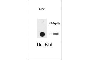 Dot Blot (DB) image for anti-SMAD Family Member 4 (SMAD4) (pThr277) antibody (ABIN3001788) (SMAD4 anticorps  (pThr277))