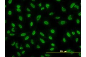 Image no. 2 for anti-YY1 Transcription Factor (YY1) (AA 221-321) antibody (ABIN599012) (YY1 anticorps  (AA 221-321))