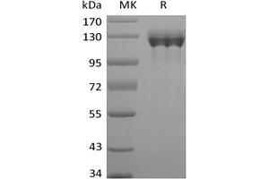 Western Blotting (WB) image for Colony Stimulating Factor 3 Receptor (Granulocyte) (CSF3R) protein (Fc Tag) (ABIN7319762)