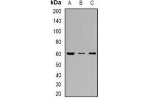 Western blot analysis of OAT3 expression in HEK293T (A), HepG2 (B), SW480 (C) whole cell lysates.