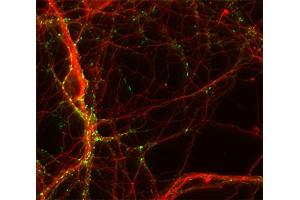 Immunocytochemistry (ICC) image for anti-Tubulin, beta 3 (TUBB3) (AA 443-450) antibody (ABIN1742554)