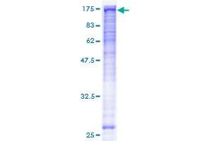 Image no. 1 for Budding Uninhibited By Benzimidazoles 1 Homolog beta (Yeast) (BUB1B) (AA 1-1050) protein (GST tag) (ABIN1346985)
