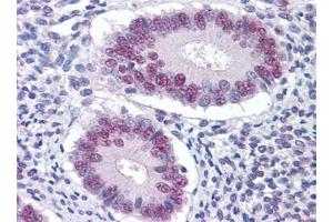 Immunohistochemistry (IHC) image for anti-serine/threonine Kinase 17a (STK17A) (AA 301-414) antibody (ABIN614691)