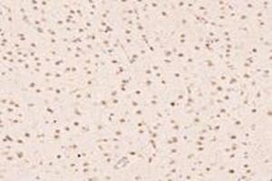 Immunohistochemistry analysis of paraffin-embedded rat substantia nigra using UBLCP1 (ABIN7076132) at dilution of 1: 4200 (UBLCP1 anticorps)