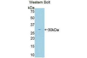 Western blot analysis of the recombinant protein. (EIF2AK2 anticorps  (AA 279-506))