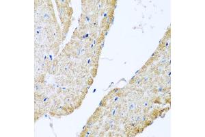 Immunohistochemistry of paraffin-embedded mouse heart using COX6B1 antibody (ABIN5974626) at dilution of 1/100 (40x lens). (COX6B1 anticorps)