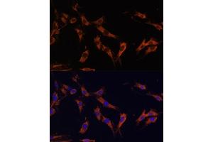 Immunofluorescence analysis of C6 cells using KSR1 Polyclonal Antibody (ABIN7268119) at dilution of 1:100 (40x lens).