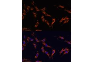 Immunofluorescence analysis of C6 cells using KSR1 Polyclonal Antibody (ABIN7268119) at dilution of 1:100 (40x lens).