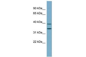 WB Suggested Anti-PRKAB1 Antibody Titration: 0. (PRKAB1 anticorps  (N-Term))
