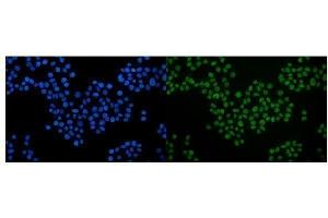 IF analysis of Serum Response Factor/SRF using anti-Serum Response Factor/SRF antibody (ABIN7600213).