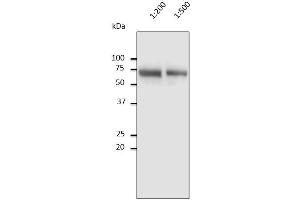 Anti-Albumin Ab at 1/2,500 dilution, 10 µl of diluted human serum per Iane, Rabbit polyclonal to goat IgG (HRP) at 1/10,000 dilution, (Albumin anticorps)