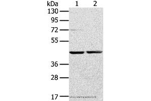 Western blot analysis of Hepg2 and hela cell, using RRAGA Polyclonal Antibody at dilution of 1:400