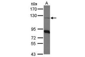 Image no. 1 for anti-Coatomer Protein Complex, Subunit beta 1 (COPB1) (AA 65-267) antibody (ABIN467583) (COPB1 anticorps  (AA 65-267))