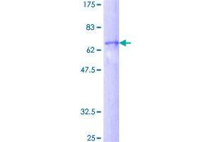Image no. 1 for DNA Fragmentation Factor, 45kDa, alpha Polypeptide (DFFA) (AA 1-331) protein (GST tag) (ABIN1351477)