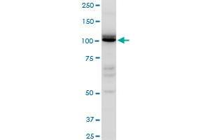 IDE polyclonal antibody (A01), Lot # ABNOVA060711QCS1. (IDE anticorps  (AA 920-1019))