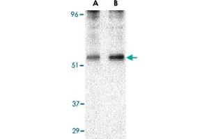 Western blot analysis of PLIN3 in EL4 cell lysate with PLIN3 polyclonal antibody  at (A) 0. (PLIN3 anticorps  (N-Term))
