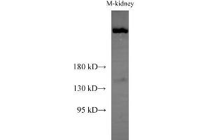 Western Blot analysis of Mouse kidney using Sptan1 Polyclonal Antibody at dilution of 1:1000 (SPTAN1 anticorps)