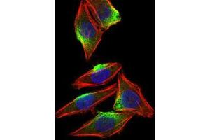Immunofluorescence analysis of HepG2 cells using CAMK4 mouse mAb (green).