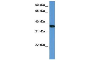WB Suggested Anti-MAPKAPK2 Antibody Titration: 0. (MAPKAP Kinase 2 anticorps  (Middle Region))