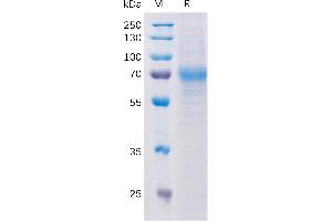 Human CD56 Protein, hFc Tag on SDS-PAGE under reducing condition.