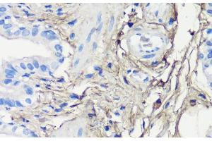 Immunohistochemistry of paraffin-embedded Rat lung using Decorin Polyclonal Antibody at dilution of 1:200 (40x lens).