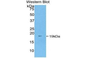 Western Blotting (WB) image for anti-Coagulation Factor II (thrombin) (F2) (AA 201-324) antibody (ABIN1859317) (Prothrombin anticorps  (AA 201-324))