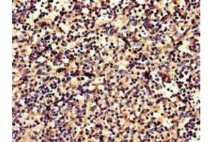 Immunohistochemistry of paraffin-embedded human spleen tissue using ABIN7146648 at dilution of 1:100 (CNR2 anticorps  (AA 305-360))
