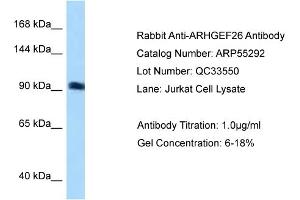 WB Suggested Anti-ARHGEF26 Antibody Titration: 0. (SGEF anticorps  (N-Term))