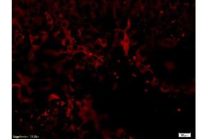 Formalin-fixed and paraffin-embedded rat liver labeled with Anti-NGFR/p75NTR Polyclonal Antibody, Unconjugated (ABIN725660) 1:200, overnight at 4°C, The secondary antibody was Goat Anti-Rabbit IgG, PE conjugated used at 1:200 dilution for 40 minutes at 37°C