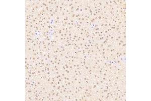 Immunohistochemistry analysis of paraffin-embedded mouse liver using,RanBP16 (ABIN7073901) at dilution of 1: 2000