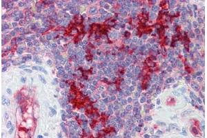 Human Spleen (formalin-fixed, paraffin-embedded) stained with RAE1 antibody ABIN462225 followed by biotinylated goat anti-rabbit IgG secondary antibody ABIN481713, alkaline phosphatase-streptavidin and chromogen.