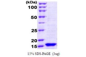 Ferric Uptake Regulator (AA 1-148) protein