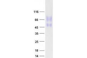 Validation with Western Blot