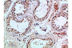 Immunohistochemical analysis of paraffin-embedded Human-testis, antibody was diluted at 1:100