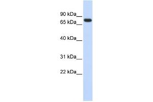 WB Suggested Anti-ANKRD13B Antibody Titration: 0. (ANKRD13B anticorps  (Middle Region))