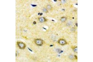 Immunohistochemical analysis of Cytochrome P450 2W1 staining in human brain formalin fixed paraffin embedded tissue section.