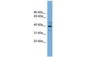 Image no. 1 for anti-BCL2/adenovirus E1B 19kD Interacting Protein Like (BNIPL) (AA 251-300) antibody (ABIN6746355) (BNIPL anticorps  (AA 251-300))