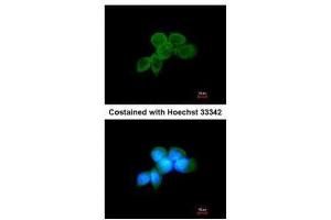 ICC/IF Image Immunofluorescence analysis of methanol-fixed A431, using SYK, antibody at 1:200 dilution.