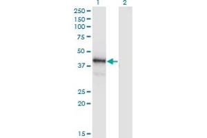 Western Blot analysis of POU4F1 expression in transfected 293T cell line by POU4F1 monoclonal antibody (M04), clone 7B4.