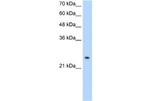 WB Suggested Anti-ADH6 Antibody Titration:  1. (ADH6 anticorps  (Middle Region))
