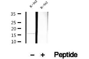 Western blot analysis of extracts of K-562 cells, using Hemoglobin epsilon antibody. (Hemoglobin, epsilon 1 (HBe1) anticorps)