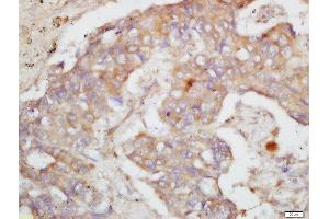 anti-CD44v4 (AA 141-240) antibody