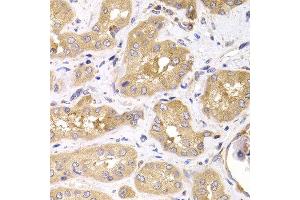 Immunohistochemistry of paraffin-embedded human kidney using RPS4X antibody at dilution of 1:100 (x400 lens). (RPS4X anticorps)