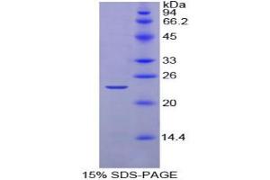 SDS-PAGE analysis of Chicken Noggin Protein. (NOG Protéine)