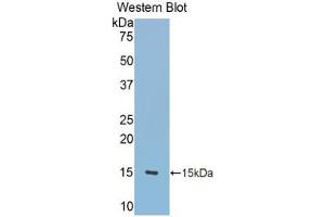 Western blot analysis of the recombinant protein. (TNC anticorps  (AA 513-621))